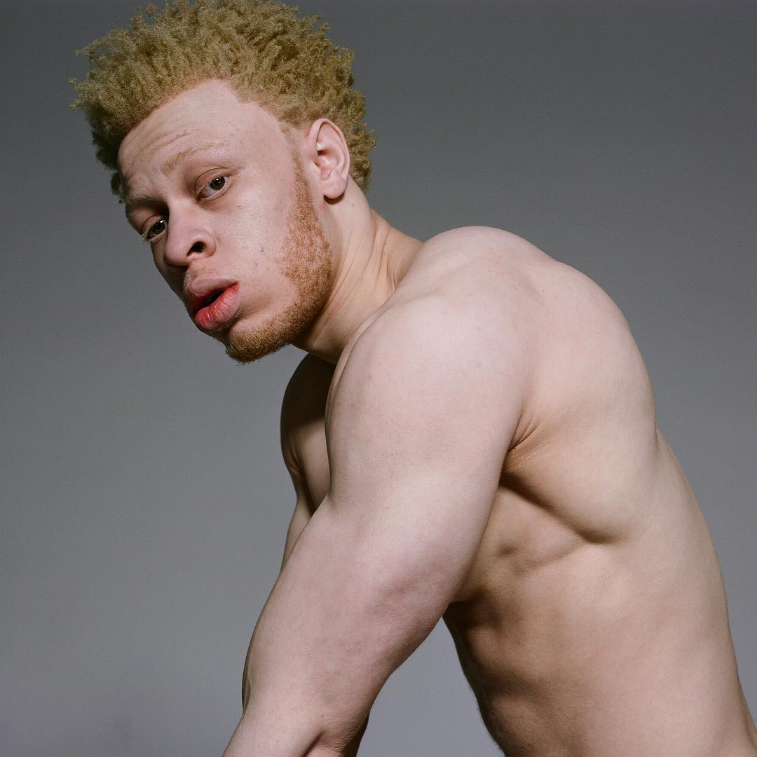 По стопам Шона Росса: модель-альбинос Лео Джона.