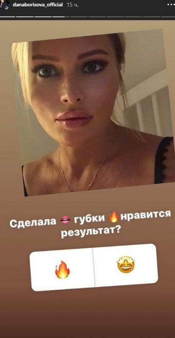 Дана Борисова увеличила губы