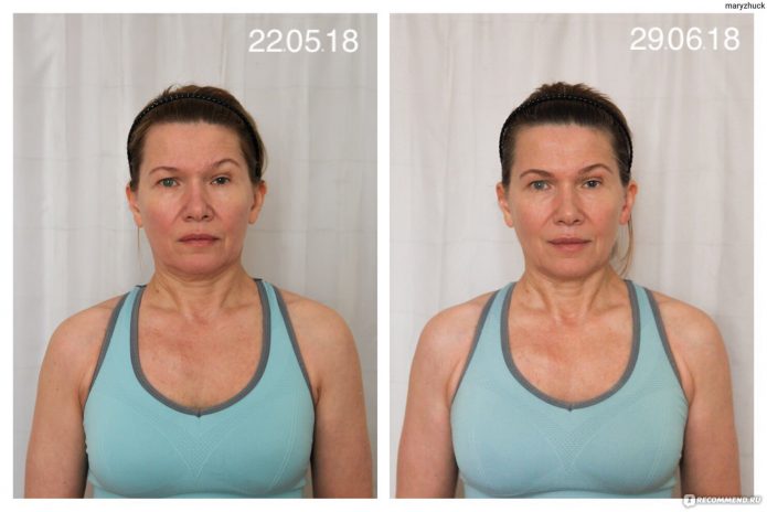 До и после упражнений Ревитоника, результат Марии, 57 лет